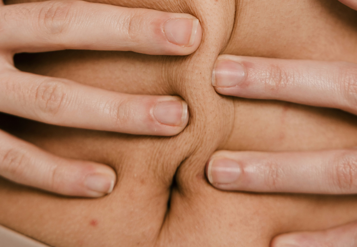 Brûleur de graisse naturel : lequel choisir pour perdre du poids